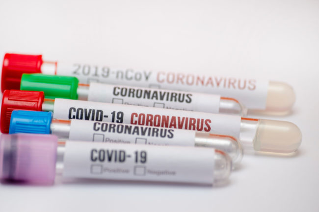 Positive COVID-19 Test